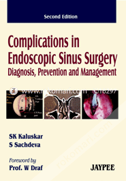 Complications in Endoscopic Sinus Surgery Diagnosis, Prevention and Management  