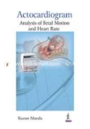 Actocardiogram: Analysis of Fetal Motion and Heart Rate