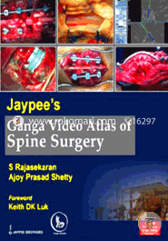 Jaypee's Ganga Video Atlas of Spine Surgery (Paperback)