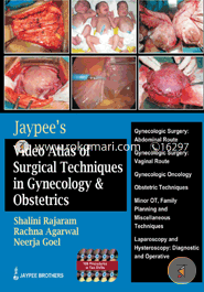 Jaypee Video Atlas of Surgical Techniques in Gynecology and Obstetrics (with 10 DVD Roms) (Paperback)