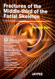 Fractures of the Middle-Third of the Facial Skelton (Paperback)