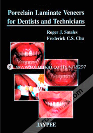 Porcelain Laminate Veneers for Dentists and Technicians (Paperback)