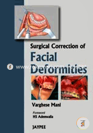 Surgical Correction of Facial Deformities (Paperback)