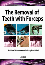 The Removal of Teeth with Forceps 