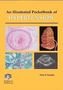 An Illustrated Pocketbook of Hypertension