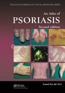 An Atlas of Psoriasis