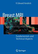 Breast MRI