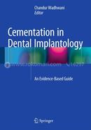 Cementation in Dental Implantology