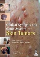 Clinical Synopsis And Color Atlas Of Skin Tumors