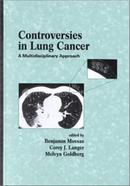 Controversies in Lung Cancer