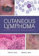 Cutaneous Lymphoma Diagnosis And Treatmnet (Hb 2012)