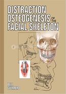 Distraction Osteogenesis of the Facial Skeleton