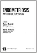 Endometriosis