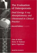 Evaluation Of Osteoporosis 