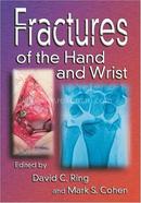 Fractures of the Hand and Wrist