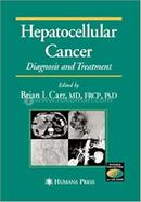 Hepatocellular Cancer: Diagnosis and Treatment