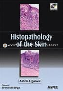 Histopathology of the Skin 