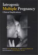 Iatrogenic Multiple Pregnancy