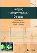 Imaging Cerebrovascular Disease