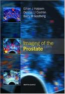 Imaging of the Prostate