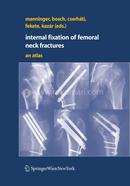 Internal Fixation Of Femoral Neck Fractures