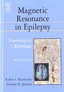 Magnetic Resonance in Epilepsy