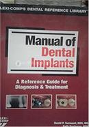Manual of Dental Implants