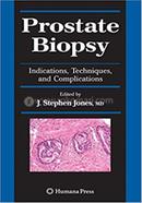 Prostate Biopsy