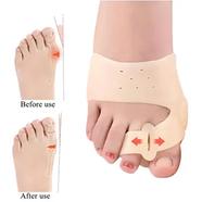 Silicone Gel Toe Separator Hallux Valgus Bunion Corrector Big Toe Straightener Thumb Valgus Protector Adjuster Feet Pads Relief