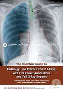The Unofficial Guide to Radiology: 100 Practice Chest X-Rays (Unofficial Guides to Medicine) image