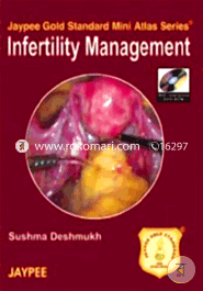 Infertility Management (with DVD Rom) (Jaypee Gold Standard Mini Atlas Series) (Paperback)