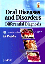 Oral Diseases and Disorders Differential Diagnosis (Paperback)
