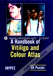 A Handbook of Vitiligo and Colour Atlas (Paperback)