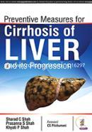 Preventive Measures for Cirrhosis of Liver and its Progression