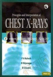Principles and Interpretation of Chest X-Rays 