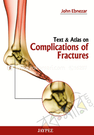 Text and Atlas on Complications of Fractures 