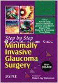 Step by Step Minimally Invasive Glaucoma Surgery 