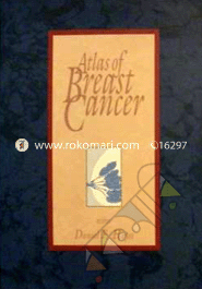 Atlas of Breast Cancer (Hardcover)