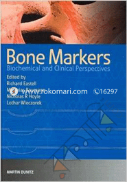 Bone Markers: Biochemical and Clinical Perspectives 
