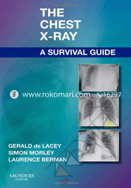 The Chest X-Ray: A Survival Guide 