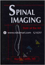 Spinal Imaging: State of the Art 
