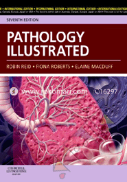 Pathology Illustrated 