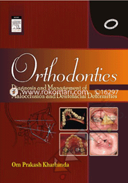 Orthodontics : Diagnosis And Management Of Malocclusion And Detofacial Deformities
