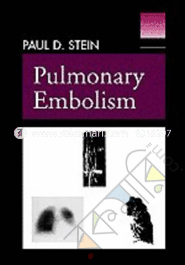 Pulmonary Embolism 