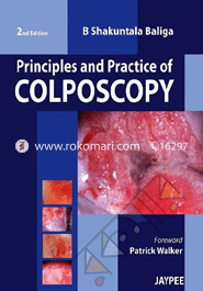 Principles and Practice of Colposcopy 