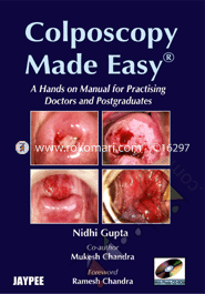 Colposcopy Made Easy (with Photo CD Rom) 