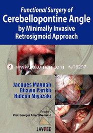 Functional Surgery of Cerebellopontine Angle by Minimally Invasive Retrosigmoid Approach 