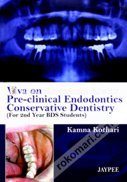 Viva on Pre - Clinical Endodontics Conservative Dentistry (Paperback)