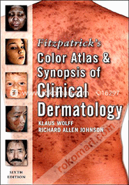 Fitzpatrick's Color Atlas and Synopsis of Clinical Dermatology (Paperback) 