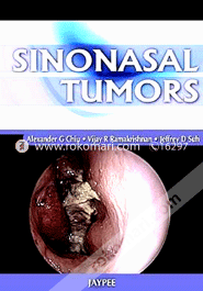 Sinonasal Tumors 